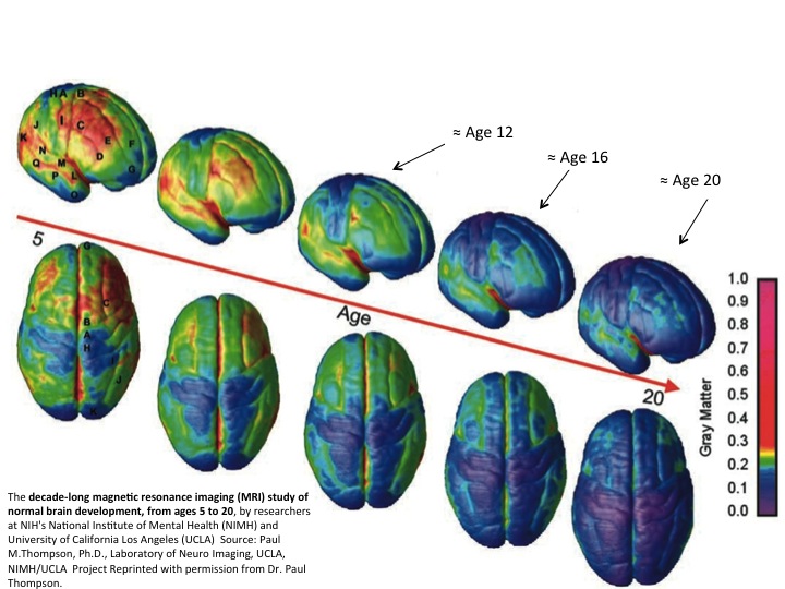 Dr. Paul Thompson's 10-year time lapse study of brain development ages 5-20 show just how much wiring - brain maturity - occurs from approximately ages 16-20. It's now understood this maturity process continues until roughly age 25.