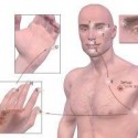 Emotional Freedom Techniques – Tool for Recovery