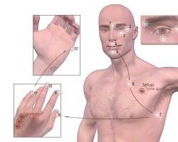 EFT Acupoints - source of image from Leanne Hall's blog on AddictionInfo.org 12/13/12: http://www.addictioninfo.org/image/eft-acupointsjpg