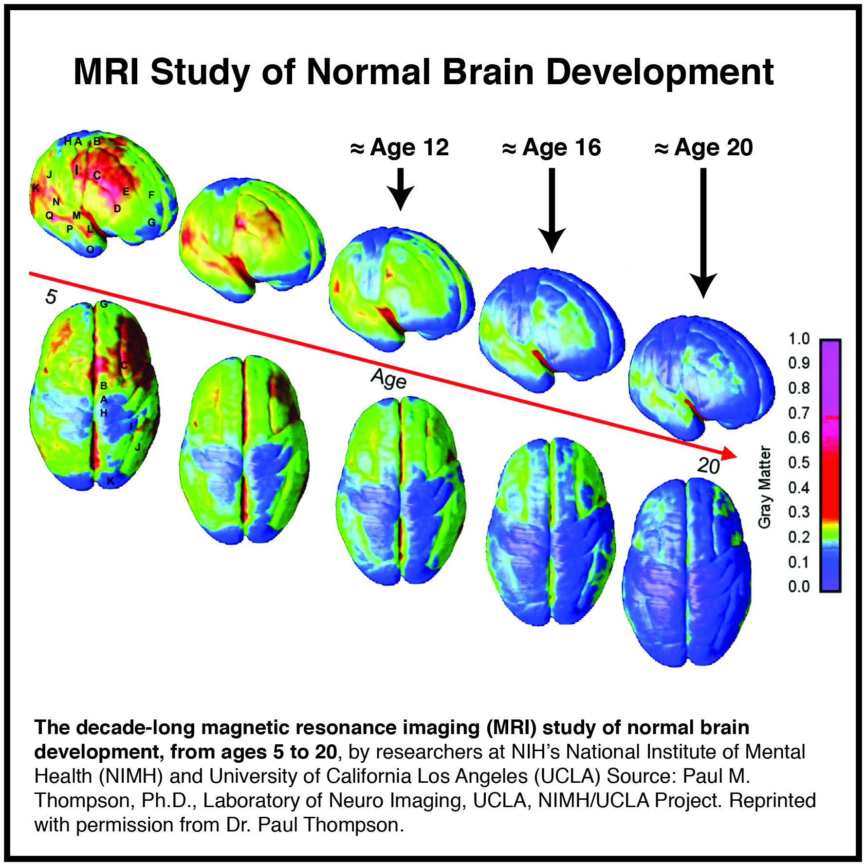 This image gives us a visual of the significant brain developmental changes occurring from ages 5 – 20. It’s now understood this brain development continues through age 22 on average for girls/women and 24 on average for boys/men.